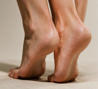Cracked Heels