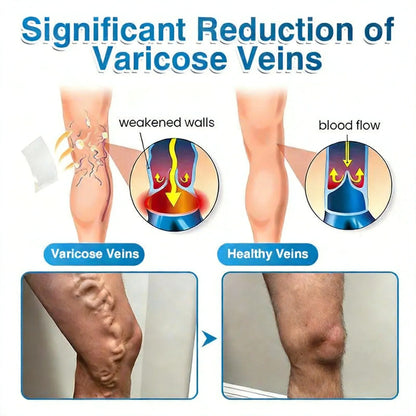 Microneedle Vein Repair Patch for Fast Spider Vein Relief