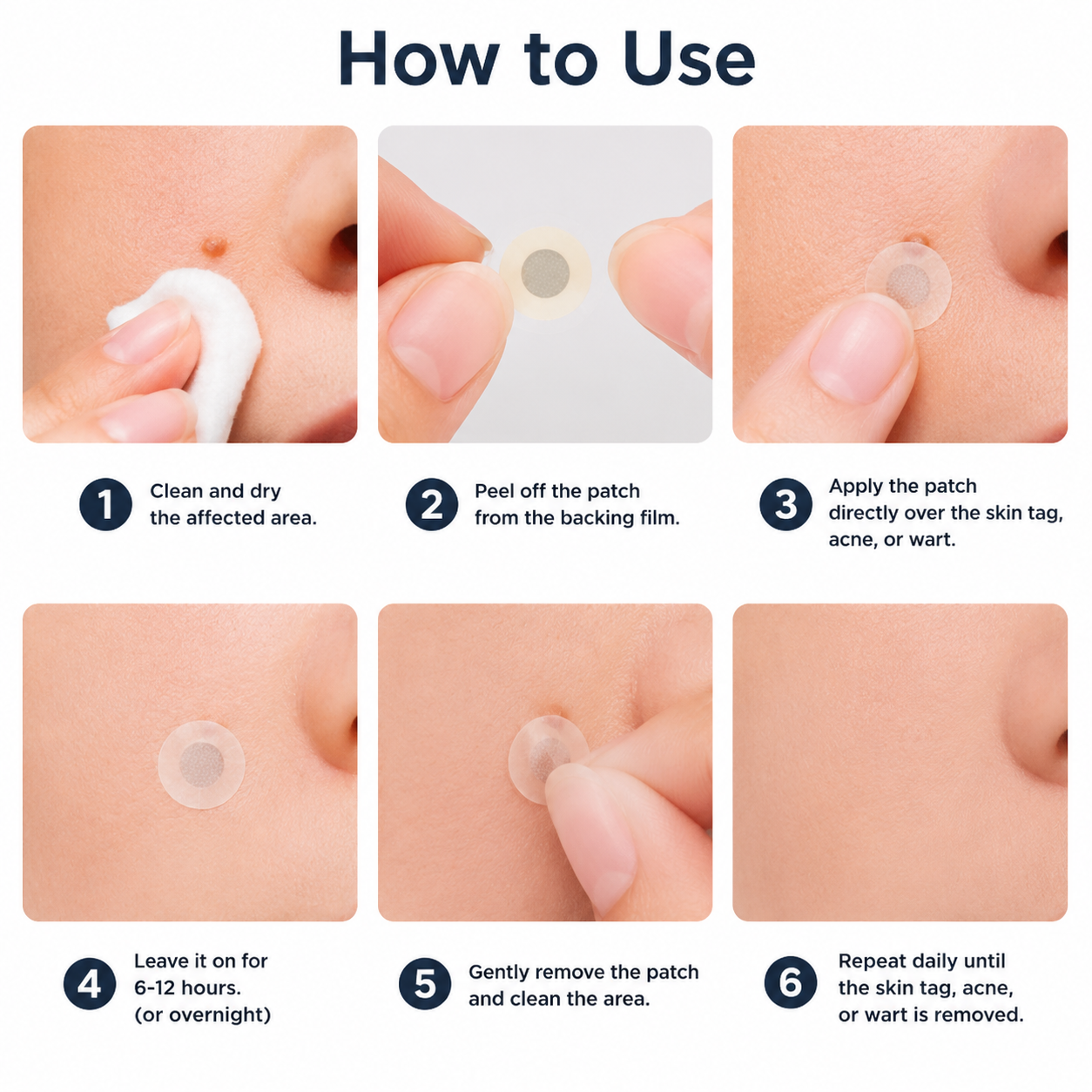 ✅🇦🇺Baelorax®2-in-1 Microneedle & Hydrocolloid Patch💫| Removes Raised Moles, Acne, Flat Warts & Skin Tags | Helps Improve Wrinkles, Scars & Blemishes | Invisible Patches for Face & Body