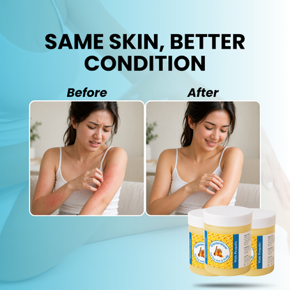 Baelorax - Repair Balm For Eczema & Psoriasis