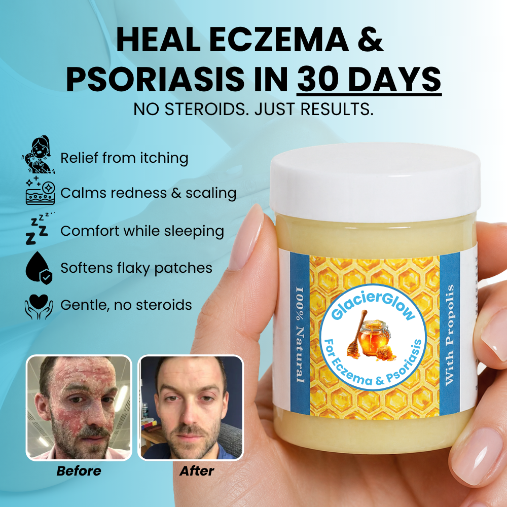 Baelorax - Repair Balm For Eczema & Psoriasis