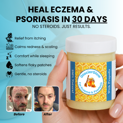 Baelorax - Repair Balm For Eczema & Psoriasis